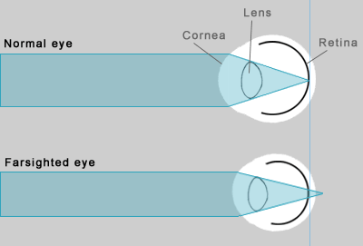 Visionweb